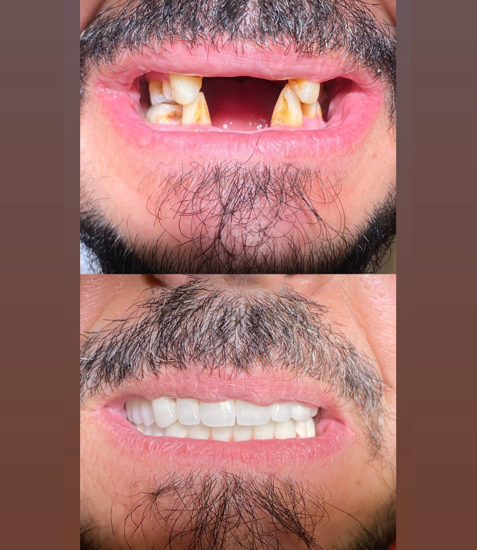 Periodontoloji